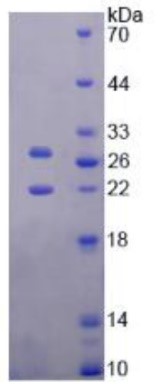 SDS PAGE (Timp3-546M).jpg